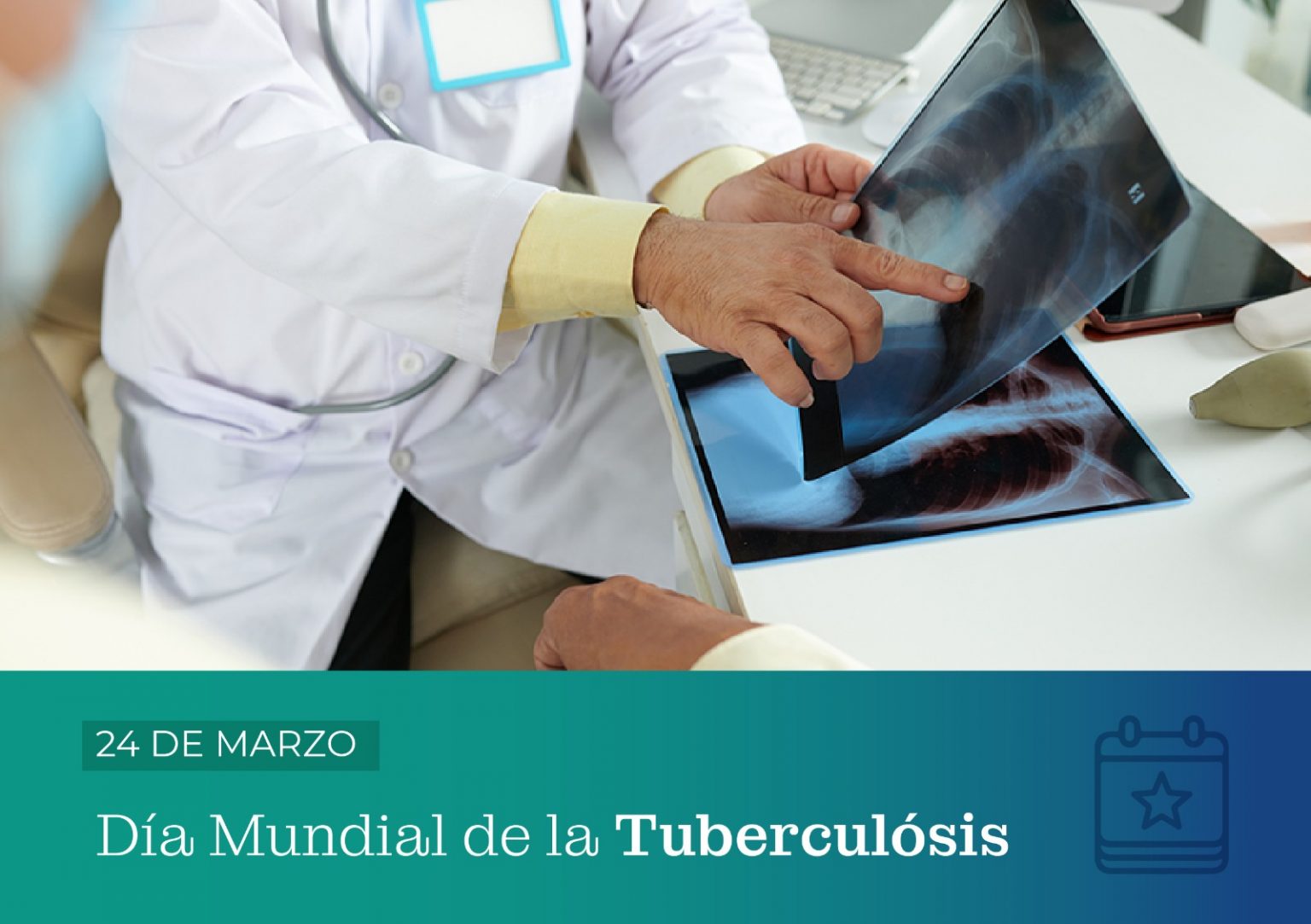 La tuberculosis se puede tratar y curar con un diagnóstico precoz thumbnail